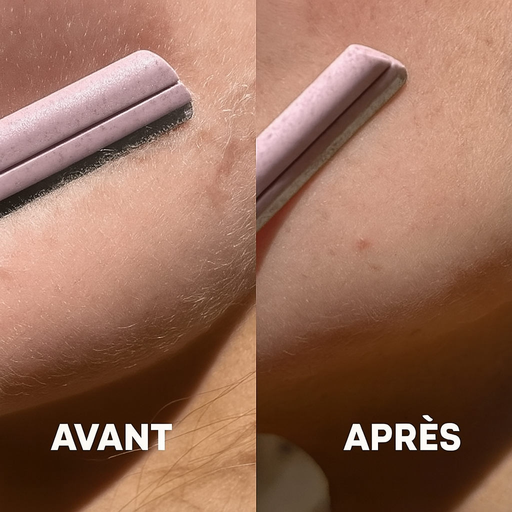 Glovolyskin® - Lames de Dermaplaning Visage