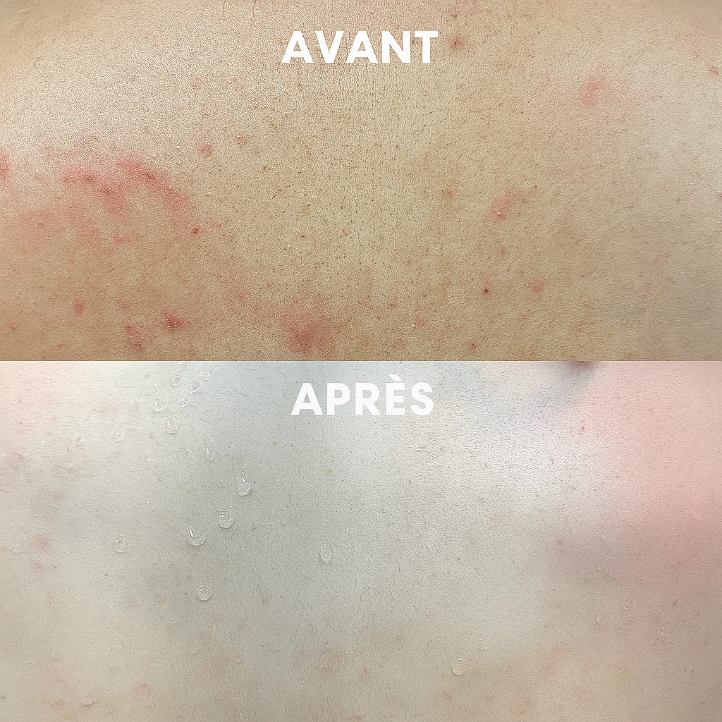 GlovolyskinÂź - Bande Exfoliante pour le Dos