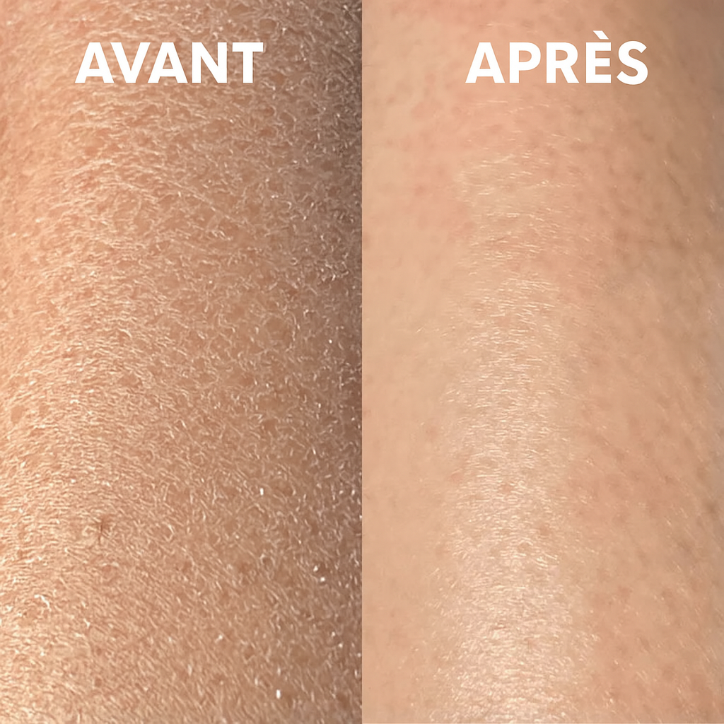 Glovolyskin® - Gant exfoliant corps